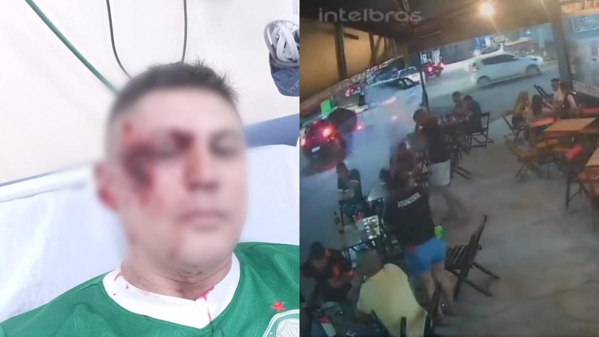 Homem apresenta ferimentos no rosto.